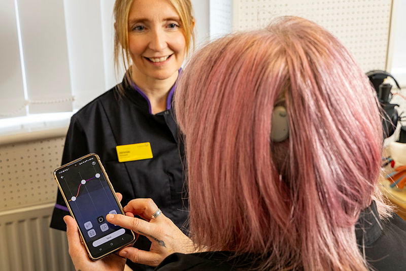 Latest News: Cochlear Osia implant